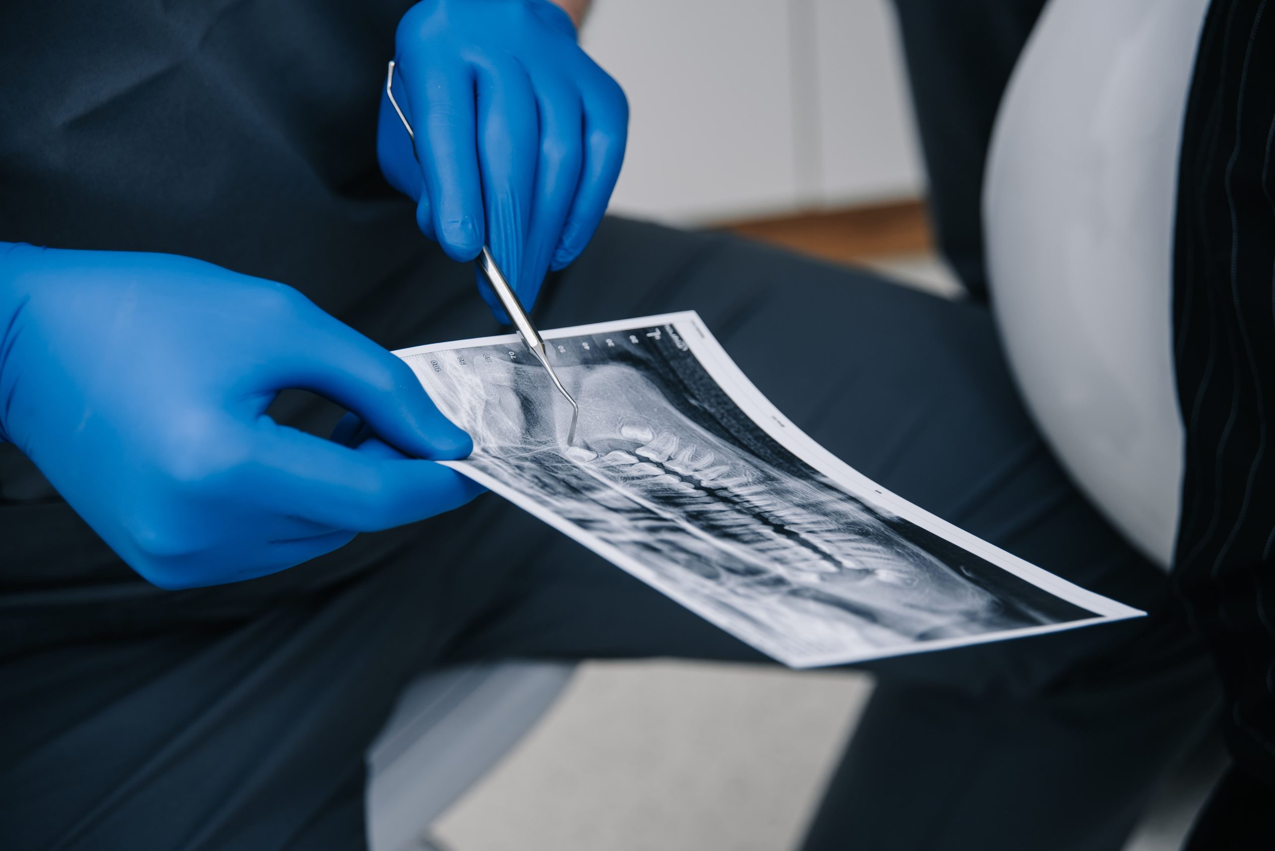 План лікування