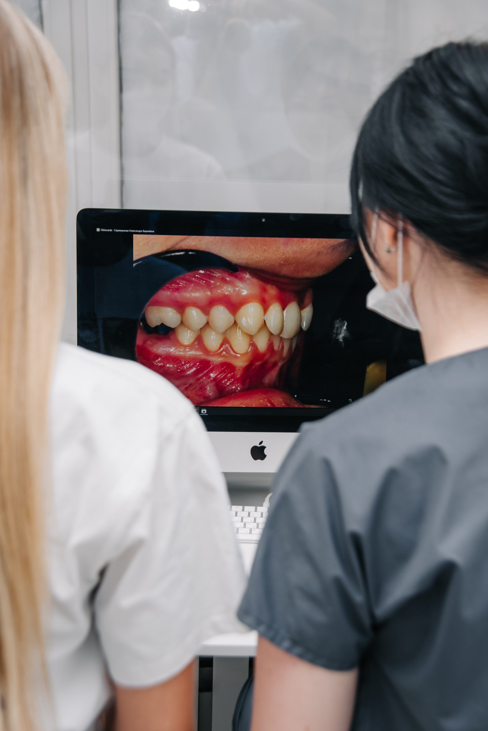 Підготовка