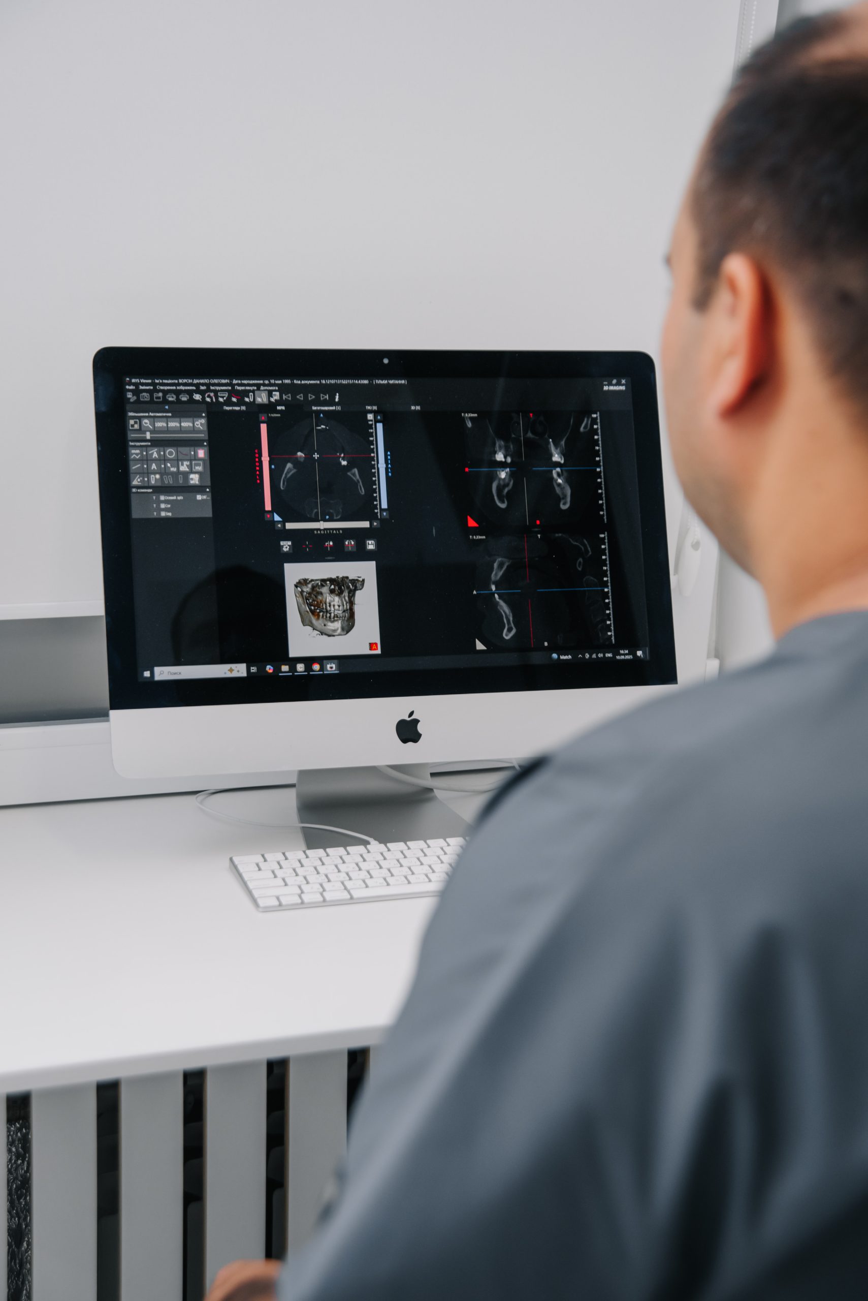 Імплантація