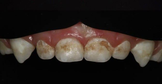 Дитяча стоматологія